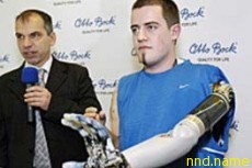 Первый в мире водитель с бионическим протезом руки попал в аварию