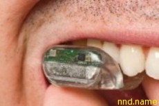 SoundBite: слуховой аппарат... на зубах