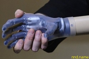 Литовец стал первым в мире человеком с бионным протезом