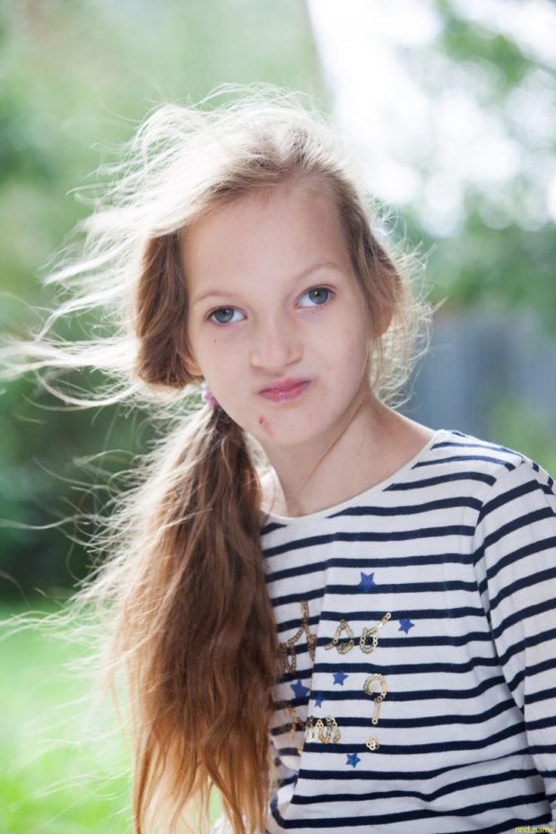 Девочка из Беларуси в фотоконкурсе Eurordis