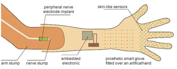 Принцип работы бионического протеза