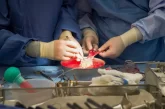 Миллион операций по пересадке органов в США