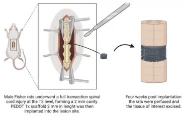 Имплантаты из гидрогеля восстановят ткани спинного мозга