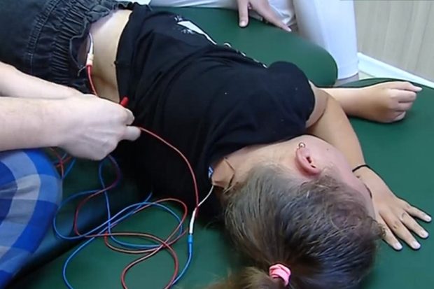 Метод стимуляции спинного мозга электрическими импульсами